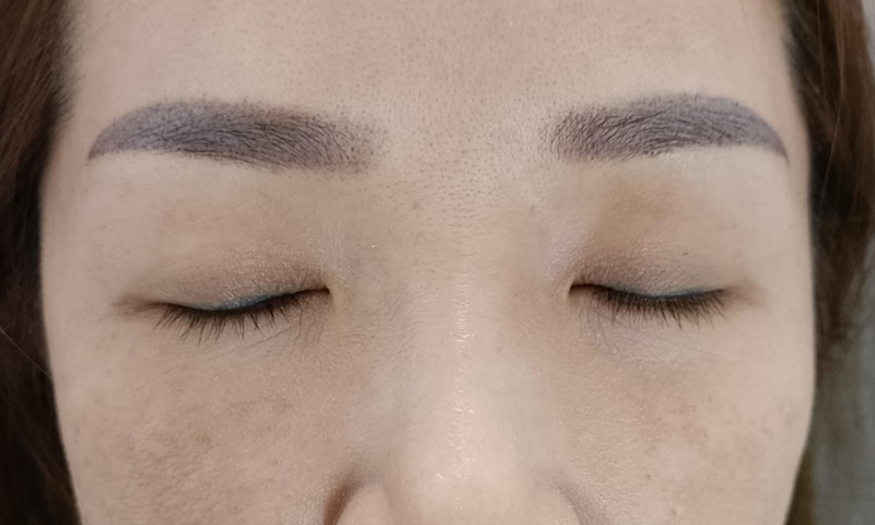 AFTER